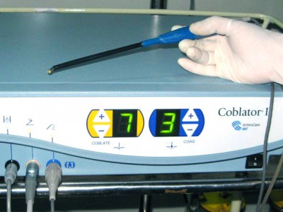 Coblator-II для работы в ЛОР хирургии: минимальное повреждение здоровых тканей